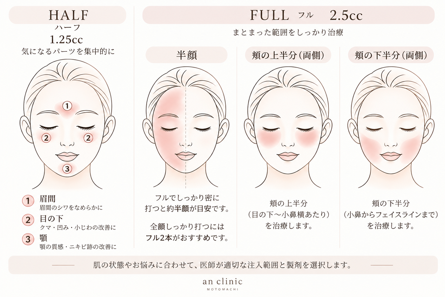 anカクテル HALF 1.25ccとFULL 2.5ccの治療範囲