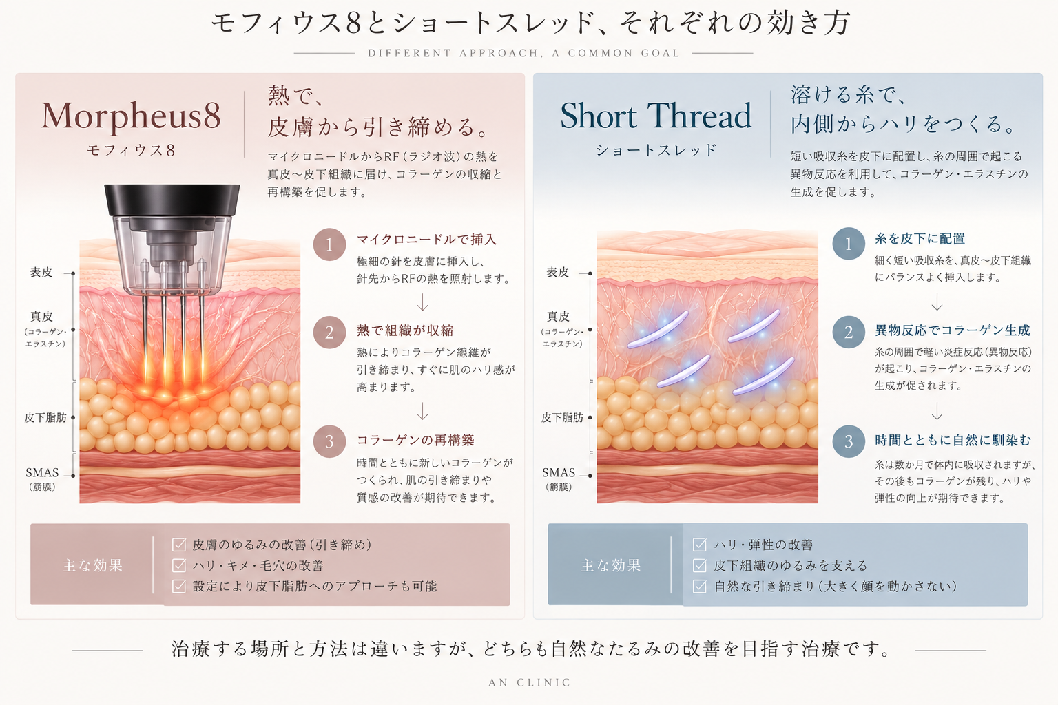 モフィウス8とショートスレッドの作用の違い。モフィウス8はRFの熱を皮膚・皮下組織へ届け、ショートスレッドは吸収糸の周囲に起こる組織反応を利用する。