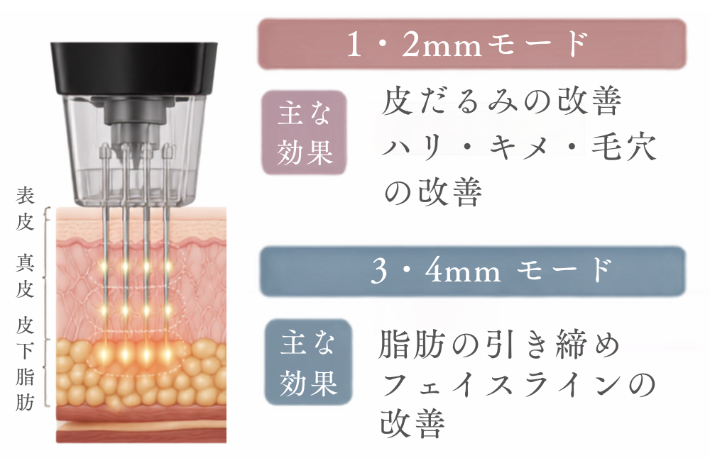モフィウス8の1・2mmと3・4mmの照射深度による作用の違い