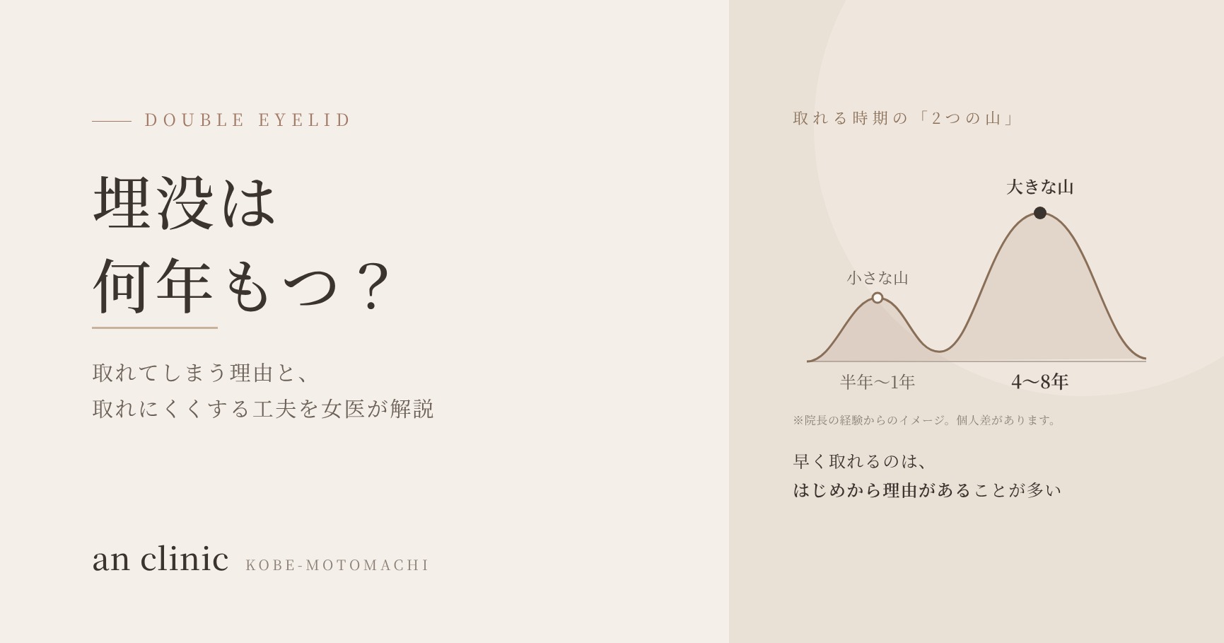埋没は何年もつ？神戸元町an clinic
