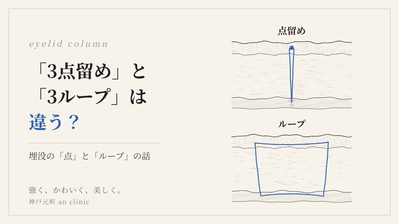 点留めとループ固定の違いのアイキャッチ